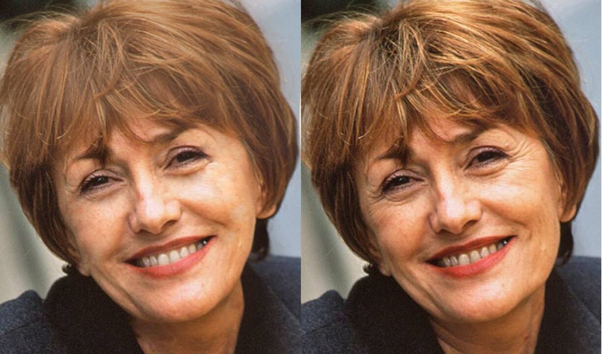 снимка на лицето преди и след контуриране